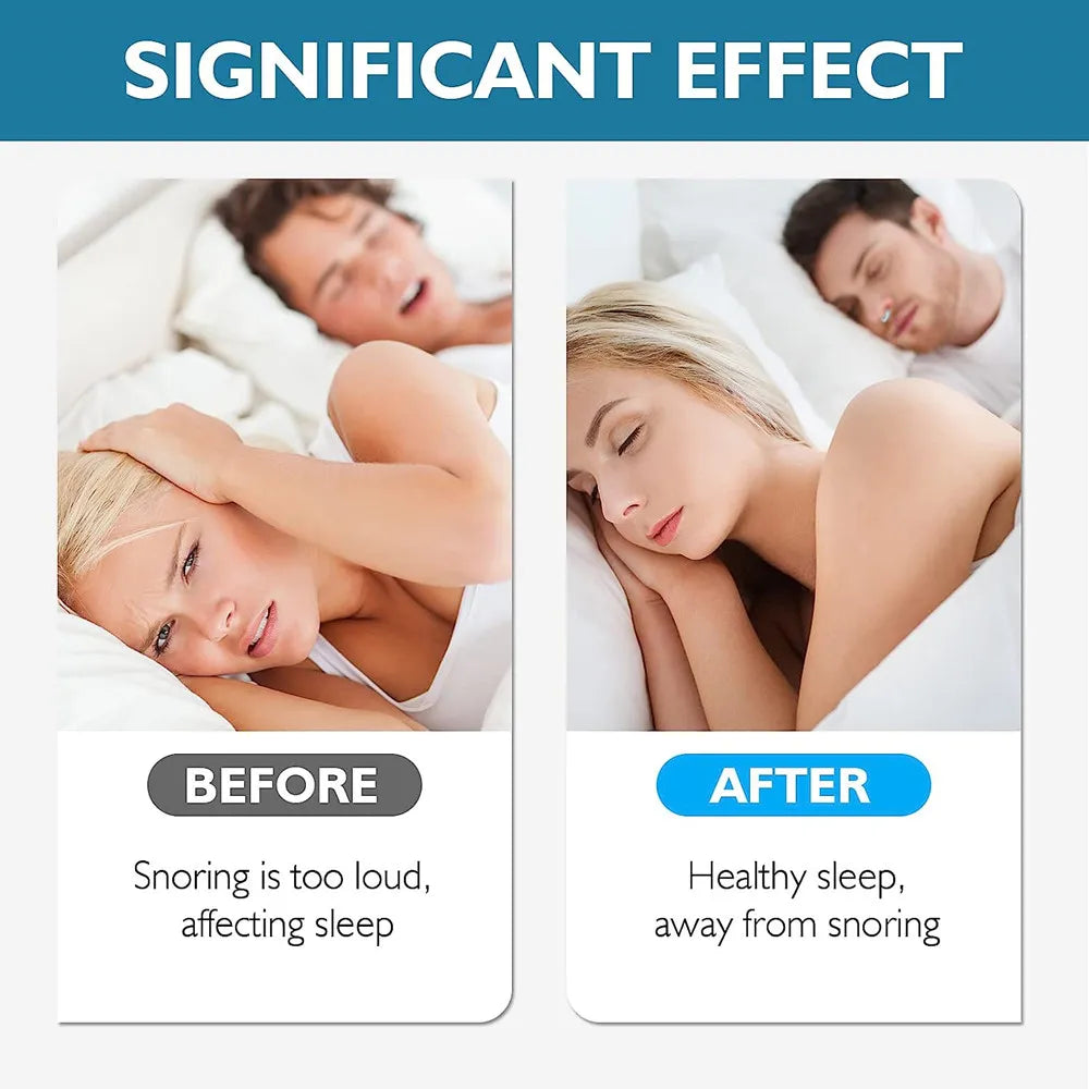 YUKUI Magnetic Anti Snoring Nose Clips - Sleep Soundly, Breathe Freely, and Wake Up Refreshed